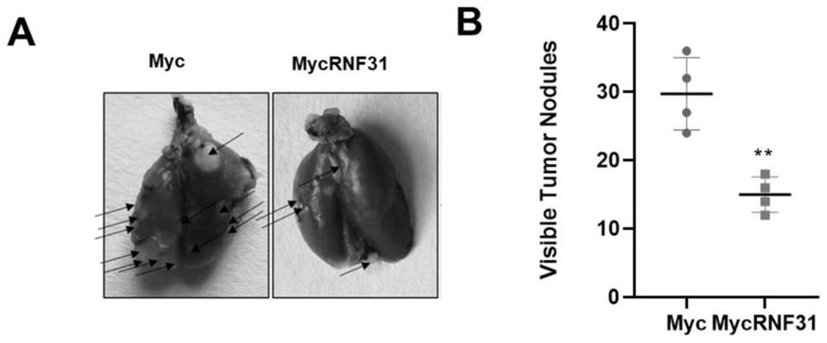 RNF31基因表達(dá)促進(jìn)劑在制備治療TNBC的藥物中的應(yīng)用