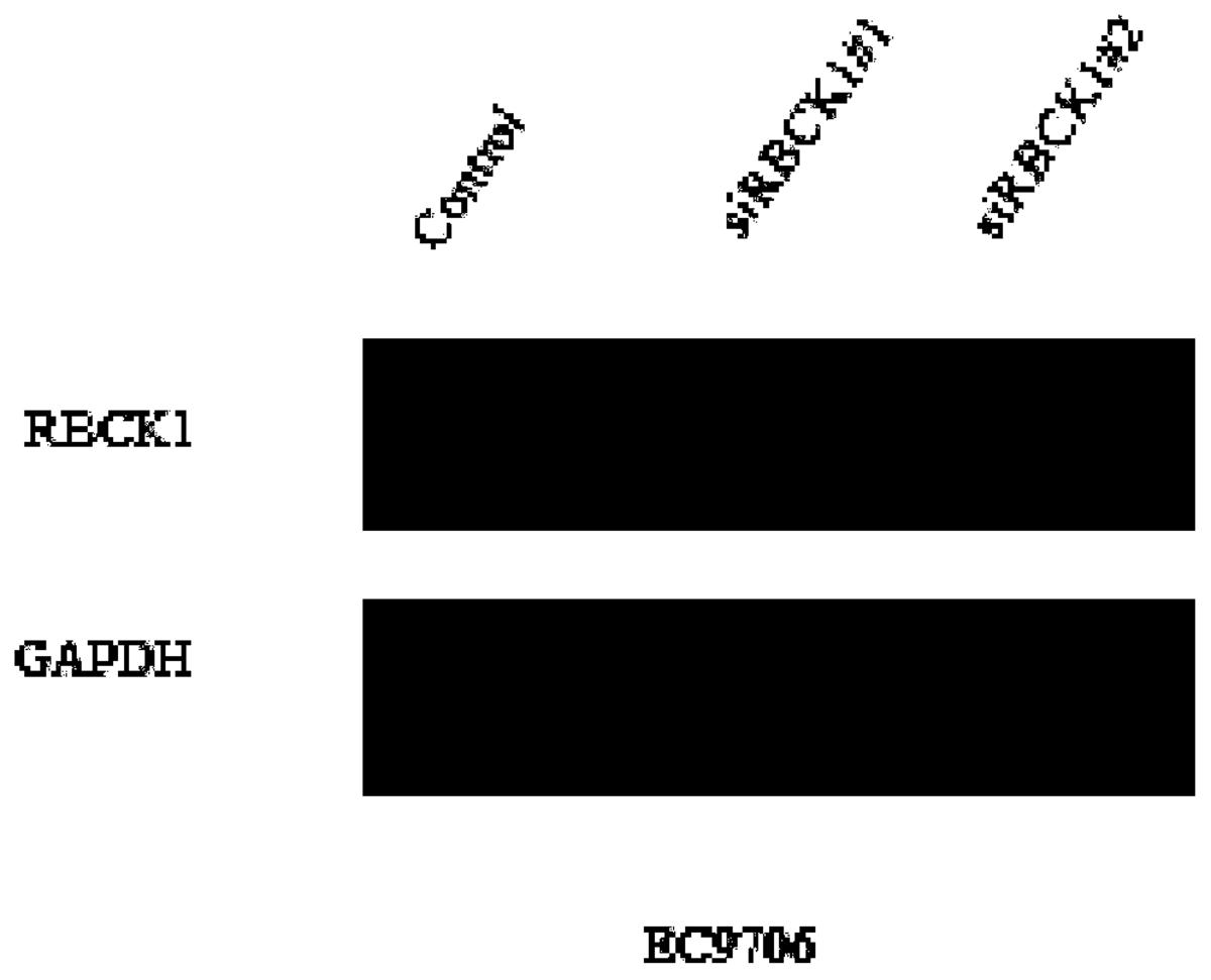 一種用于檢測(cè)食管癌細(xì)胞遷移和侵襲能力的分子標(biāo)志物及其應(yīng)用