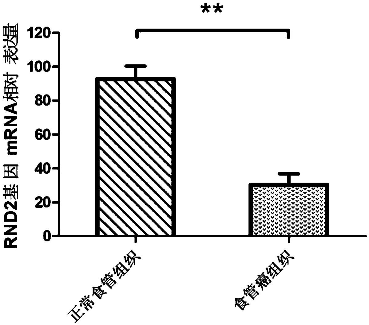 一種食管癌檢測、診斷或者預(yù)后評價制劑，治療食管癌的藥物及RND2基因的應(yīng)用